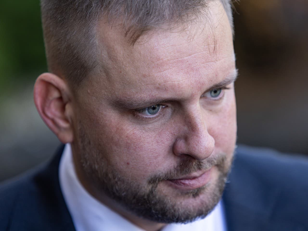 SNS kritizuje ministra Šaška za neefektívne návrhy v zdravotníctve