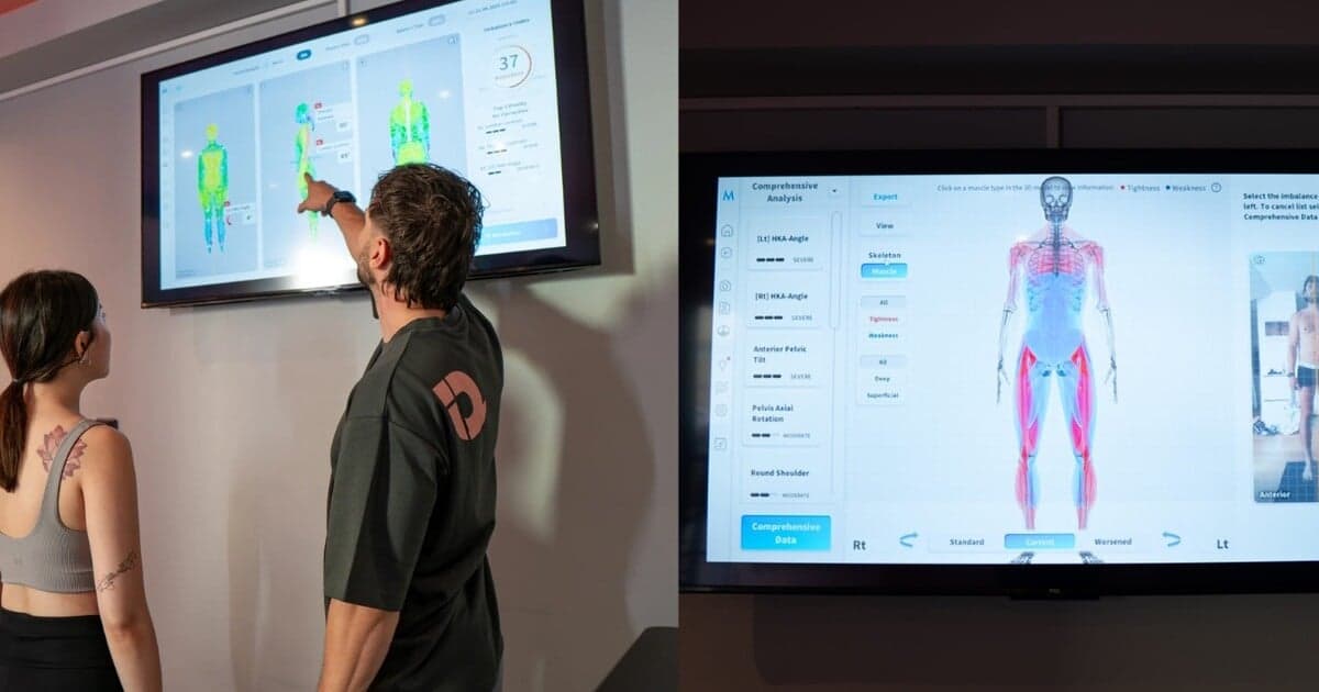 Bolesť chrbta: Problém mladých Slovákov, ktorý si zaslúži pozornosť