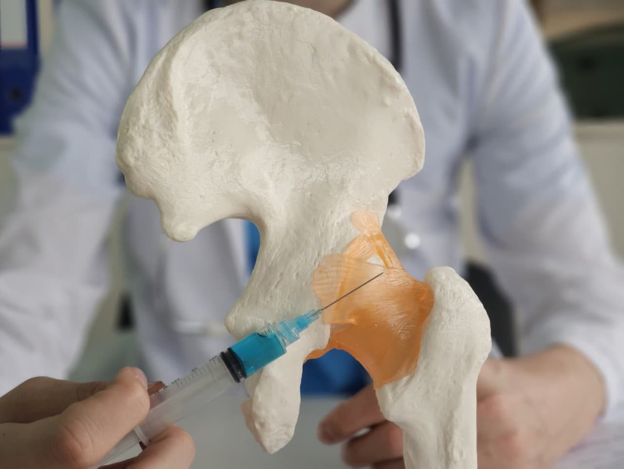 Koxartróza: Záhadný nepriateľ pohybového aparátu