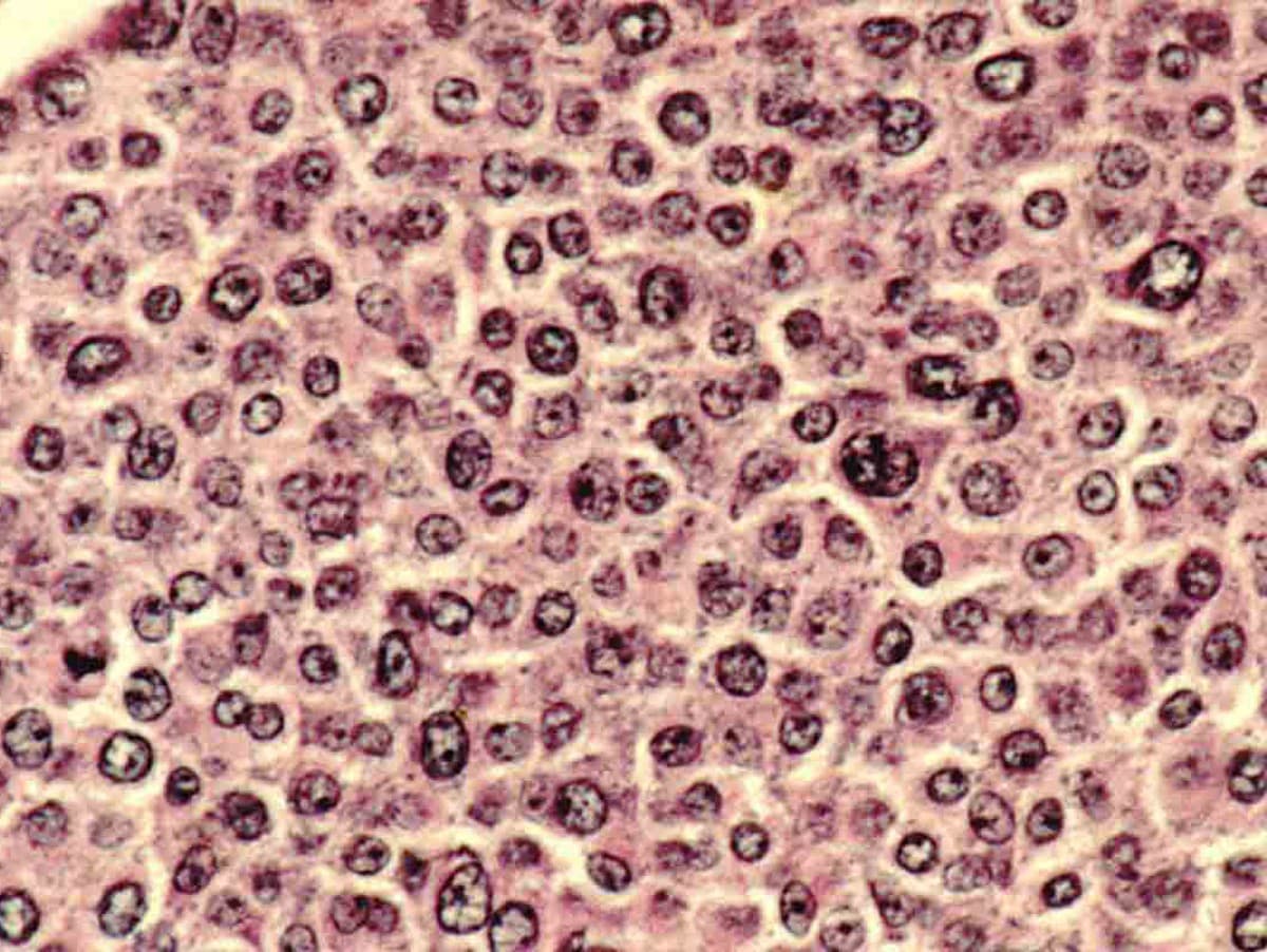 Polyamíny: Dvojsečný meč v boji proti starnutiu