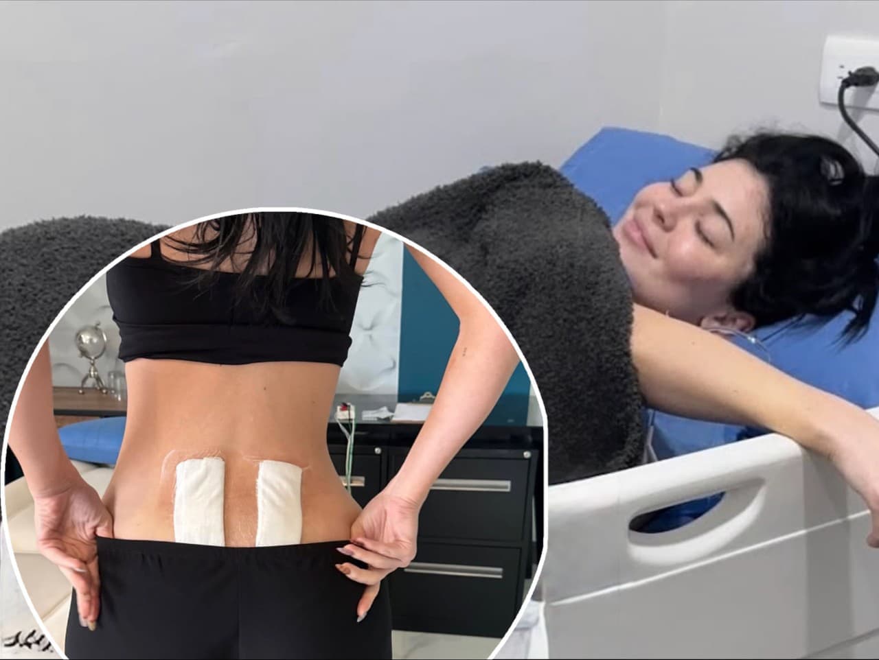 Kylie Jenner otvorene o zdravotných problémoch po pôrode