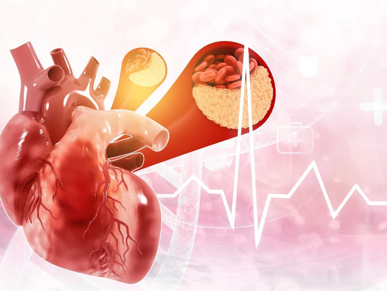 Ateroskleróza: Varovné signály, ktoré by ste nemali ignorovať