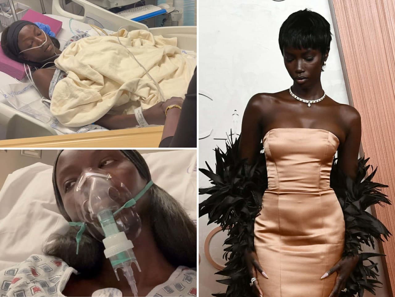 Supermodelka Anok Yai prezradila svoj tajný boj so zdravím