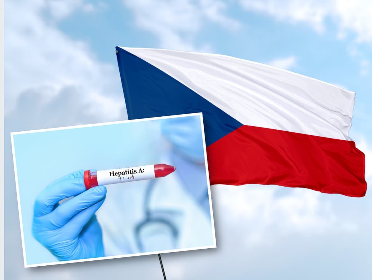 Poľsko varuje občanov pred cestami do Česka kvôli žltačke typu A