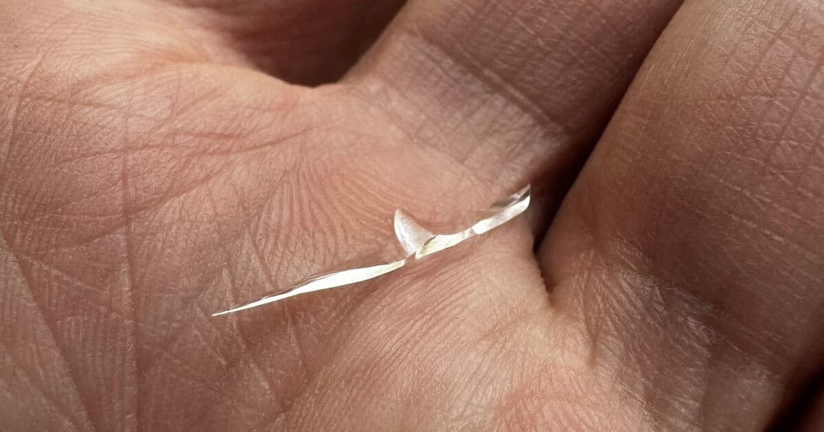 Sklo v jedle z bratislavskej reštaurácie: Zákazníčka mala vážny incident