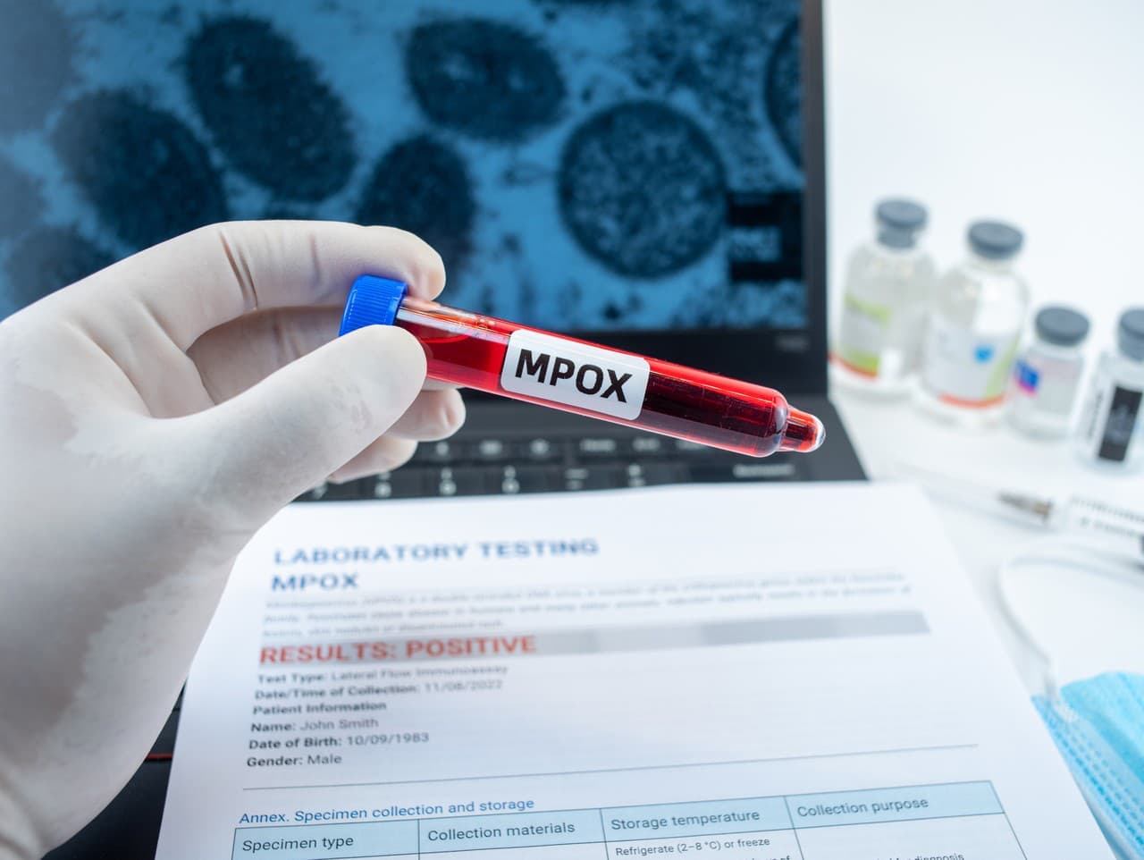 WHO varuje: Nový vírus mpox ohrozuje aj Európu