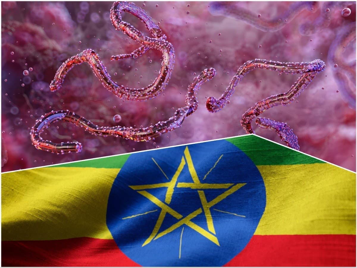 Etiópia hlási prvé ohnisko marburskej horúčky: Deväť potvrdených prípadov