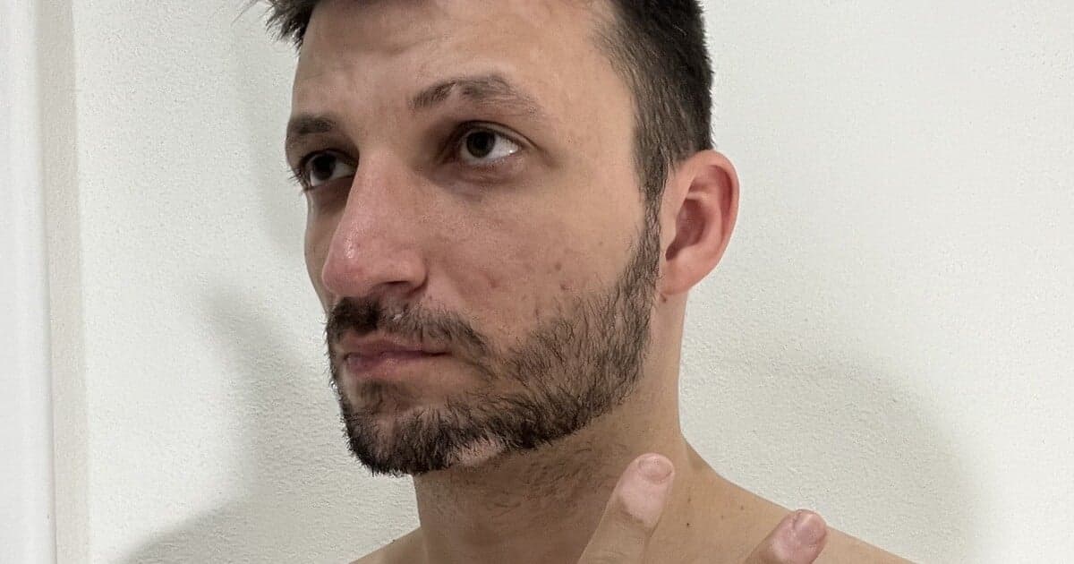 Marek a jeho boj s vitiligom: Zosobnenie predsudkov a vnútorného boja