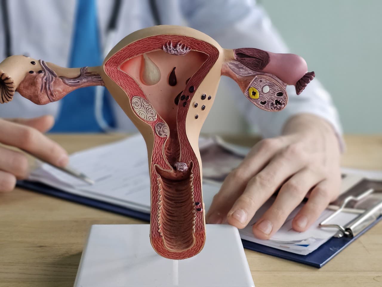 Hrozivé čísla: 4,5 milióna dievčat ohrozených mrzačením pohlavných orgánov