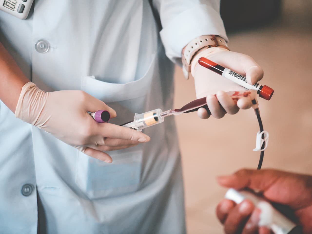 Zatvorenie odberového centra v Ružinove: Dôležité informácie pre darcov krvi