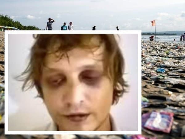 Na Bali objavili rozštvrtené telo, môže patriť unesenému synovi mafiána