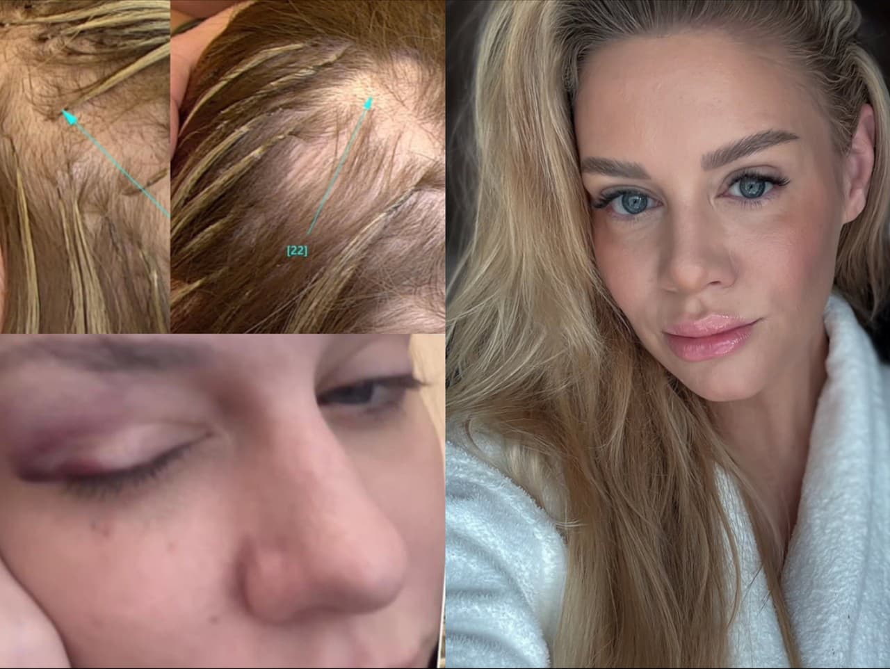 Brutálne napadnutie influencerky: Michaela Jonas prehovorila o treste