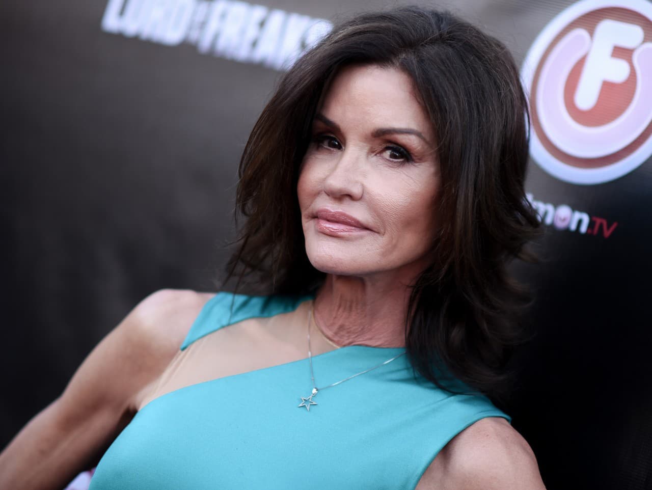 Janice Dickinson žaluje ITV: Po páde si nesie trvalé jazvy