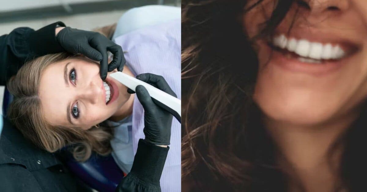 Polovica Slovákov zanedbáva dentálnu hygienu: Prečo to môže byť nebezpečné?