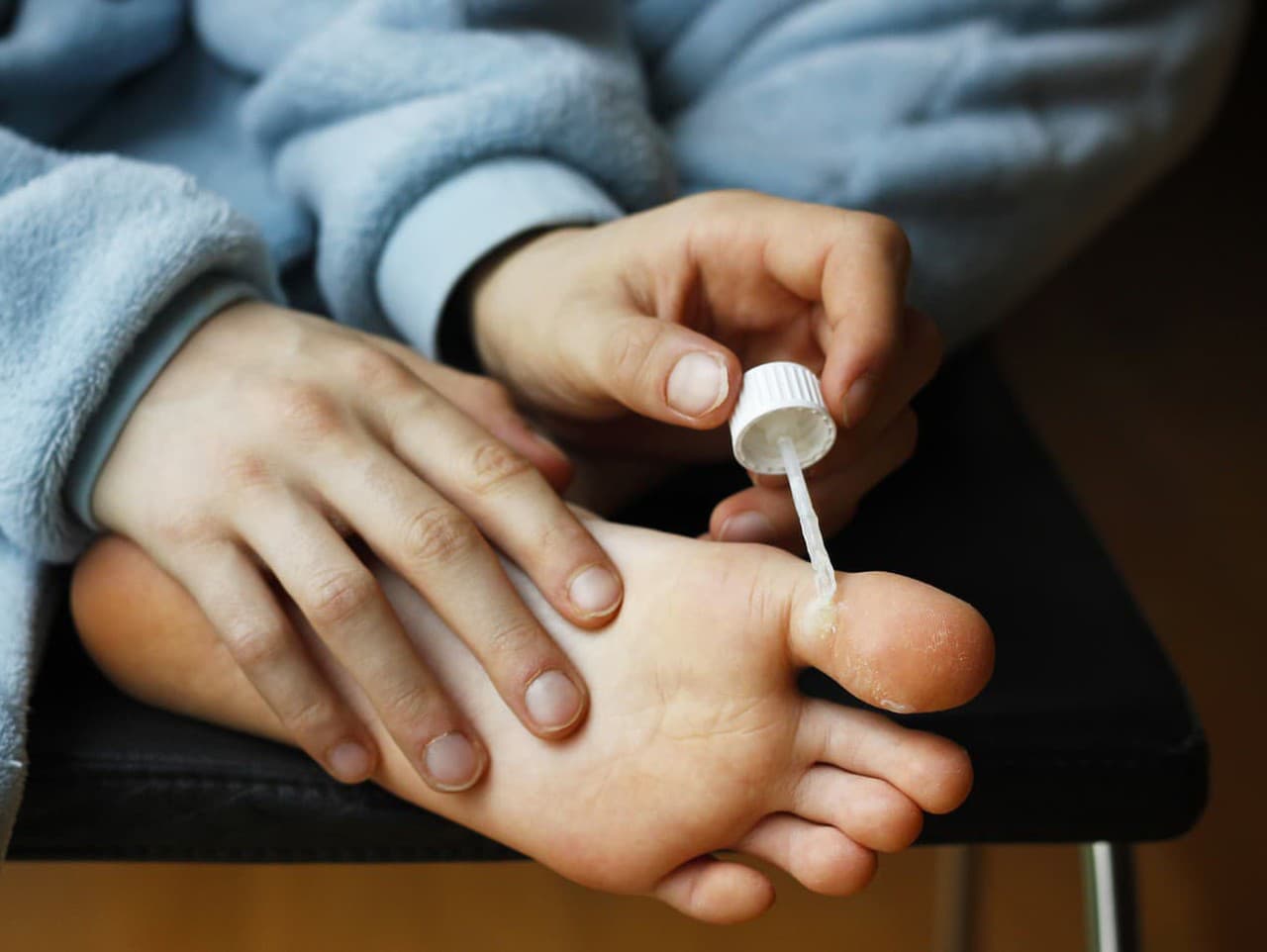 Bradavice ako ukazovateľ imunitného systému