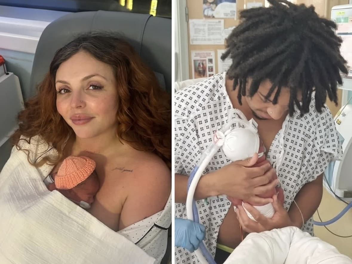 Tragická diagnóza dvojičiek speváčky Jesy Nelson: Boj o život