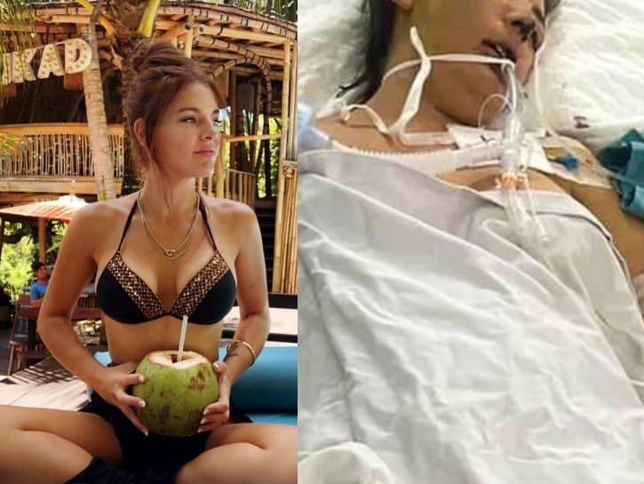 Austrálska matka po plastike tváre bojuje o život v Kóme