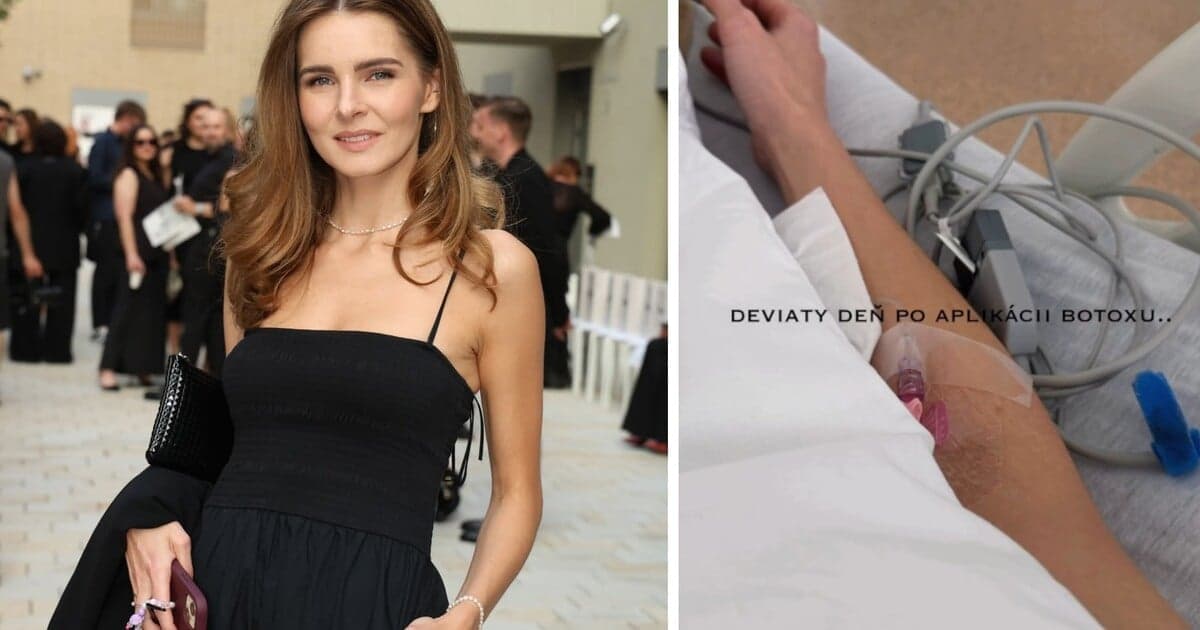 Monika Szabó v nemocnici: Zdravotné problémy po estetickom zákroku
