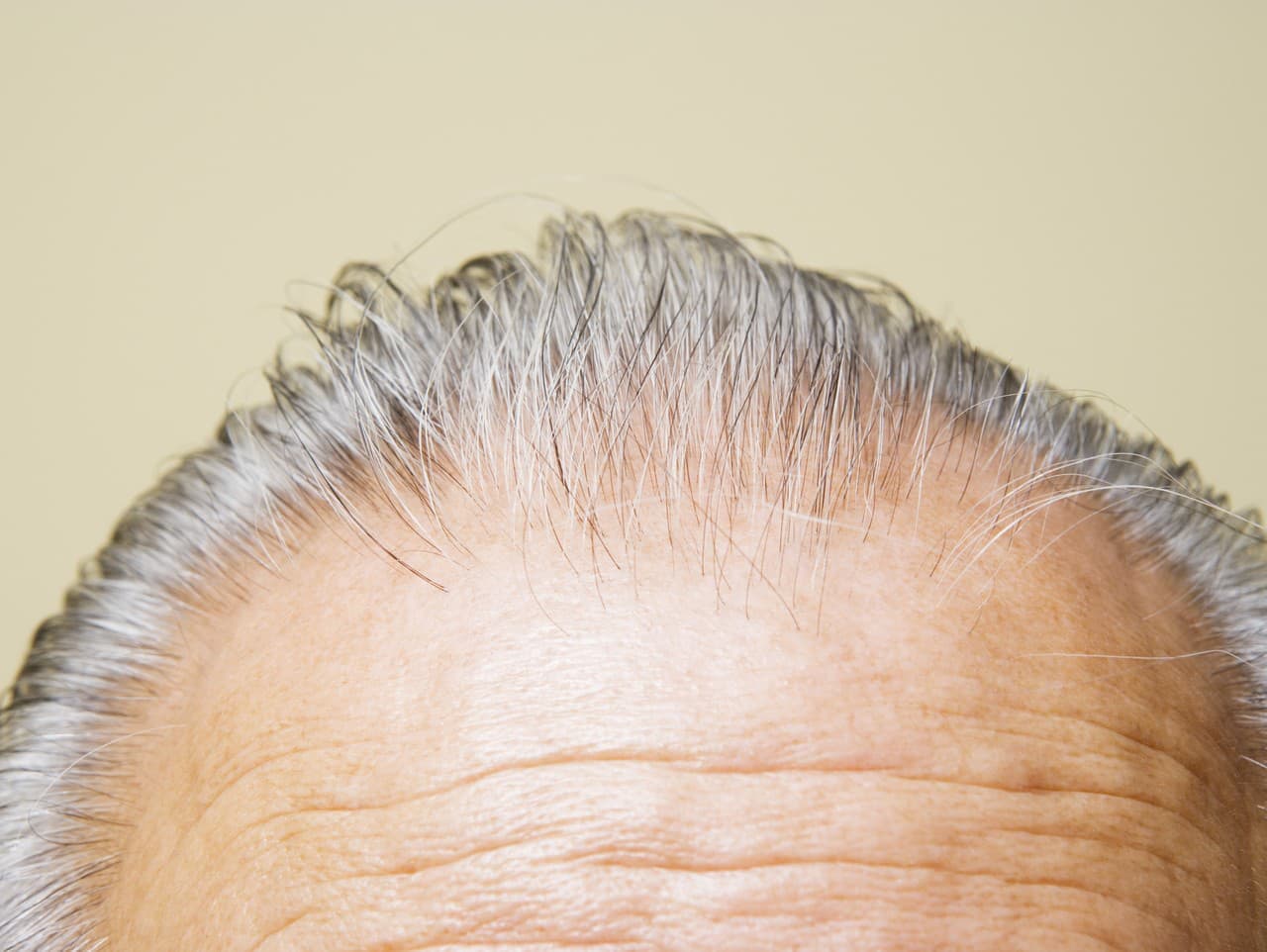 Šedivé vlasy: Nový pohľad na ich ochrannú funkciu proti rakovine