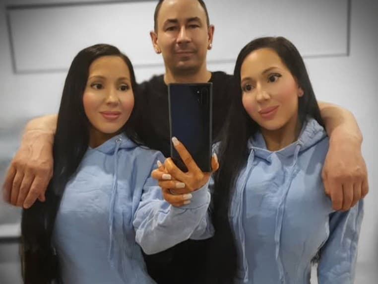 Jednovaječné dvojčatá zdieľajú lásku a plány na tehotenstvo