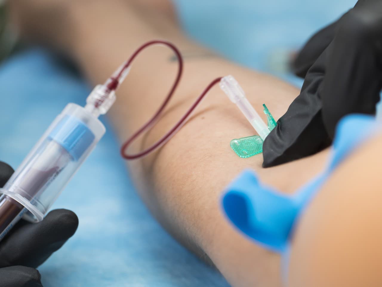 Biologický vek: Ako strava ovplyvňuje starnutie tela