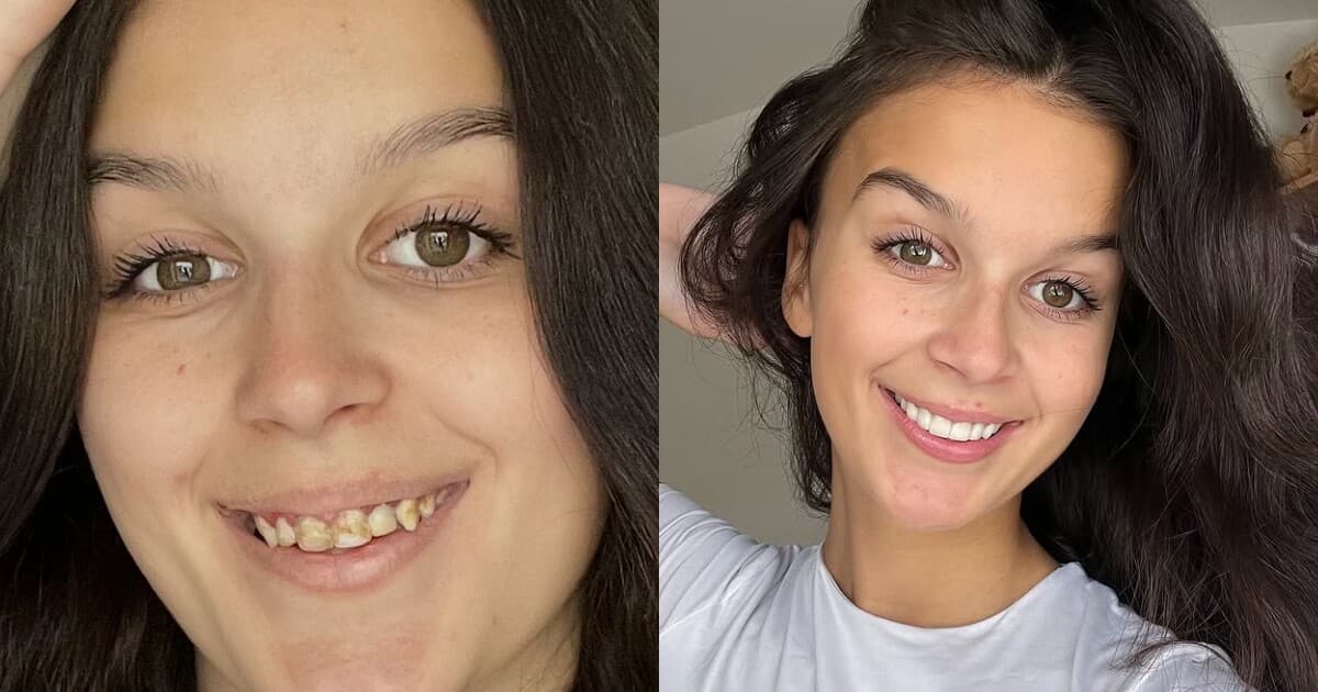 Veronika a jej boj s tetracyklínovými zubami