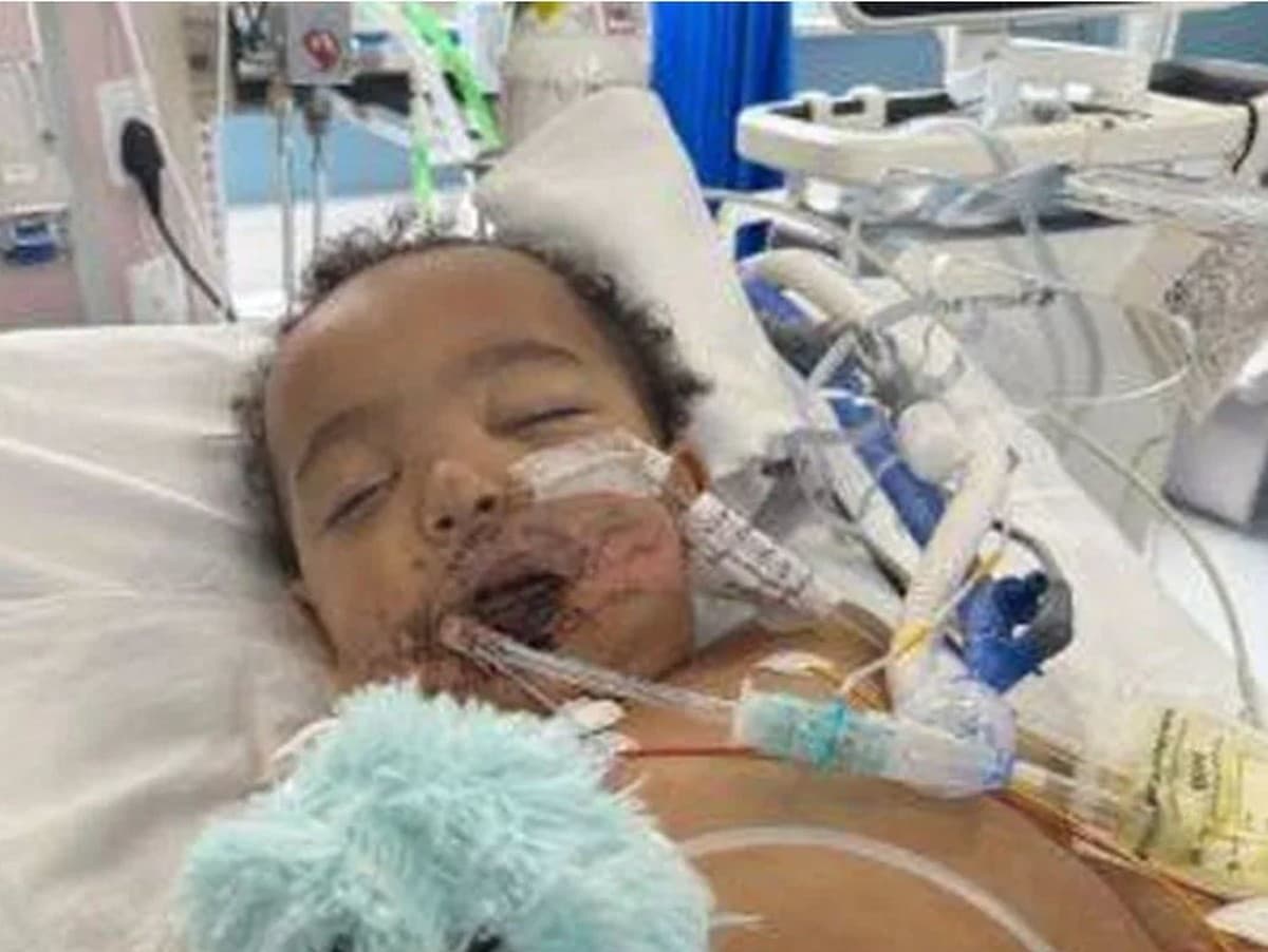 Desivá nehoda: Malý Sam prežil infarkt po vypití žieraviny