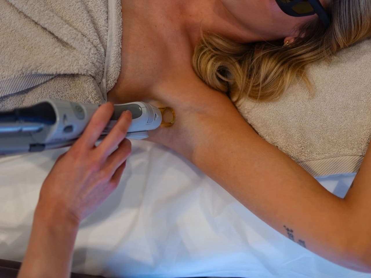 Ktorý laser na epiláciu si vybrať? Porovnanie diódového a alexandritového