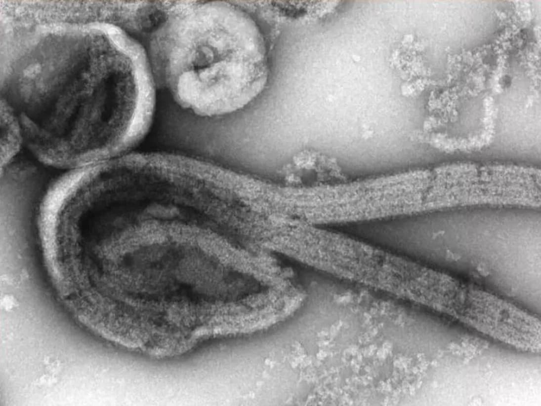 Vírus Marburg sa opäť šíri v Etiópii: Úrady vyzývajú na obozretnosť