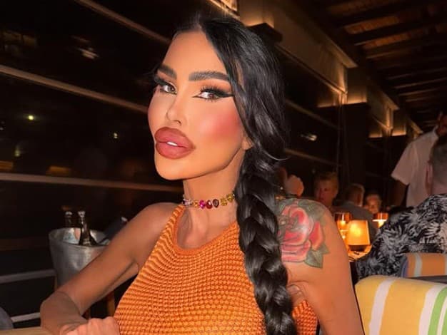 Živá Barbie šokuje: Tara Jayne ukázala fotografie pred zákrokmi