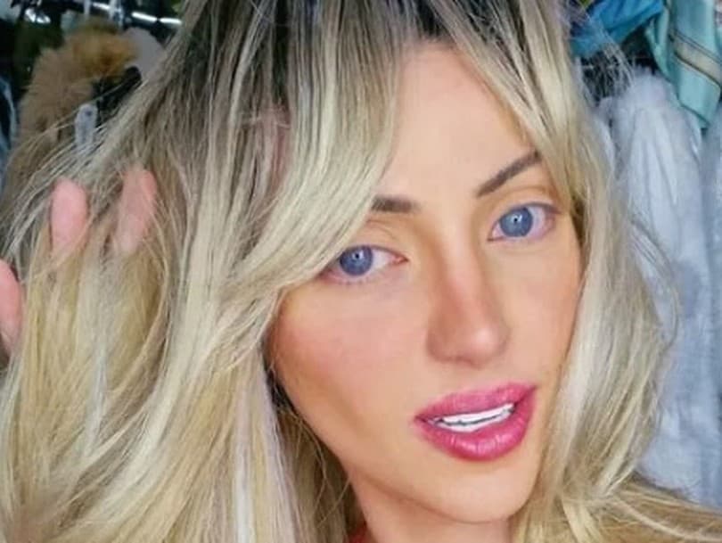 Tragédia influencerky: Smrť 'ľudskej Barbie' šokovala Brazíliu