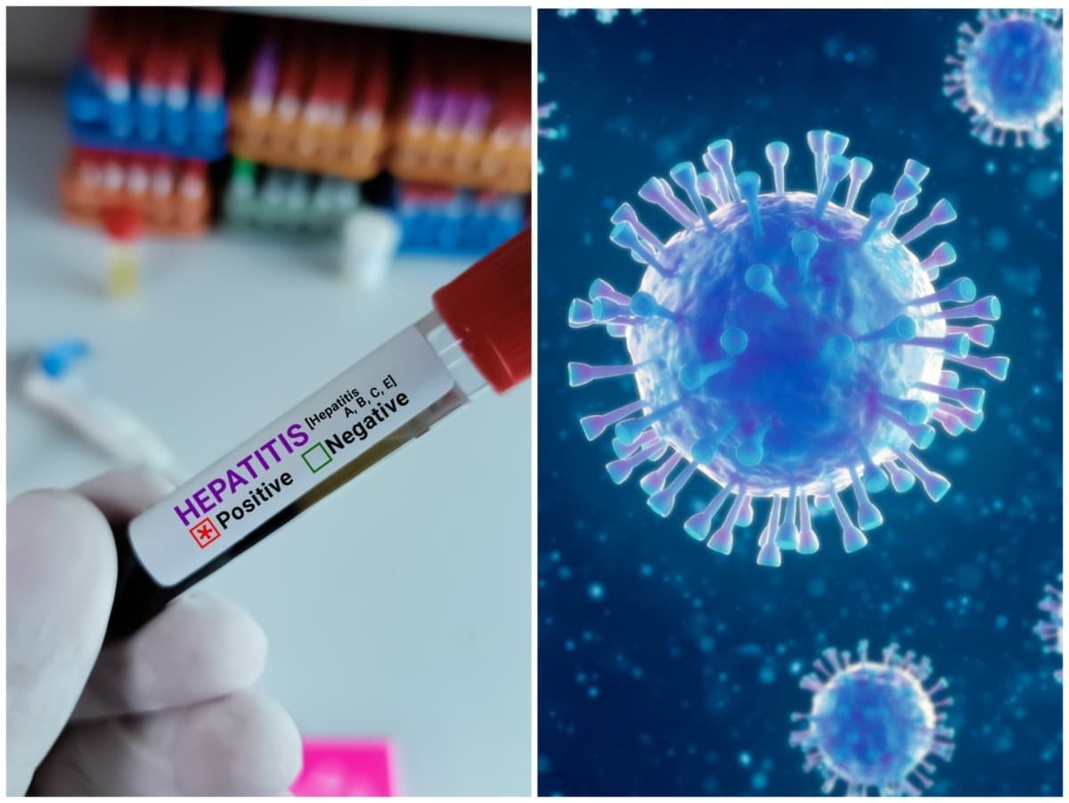 Trnavský kraj čelí trojnásobnému nárastu žltačky typu A