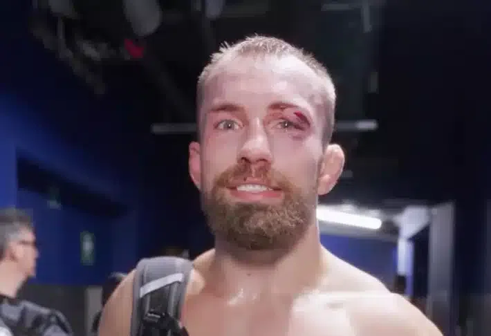 Lajoš Klein po operácii: Optimistické správy pre fanúšikov