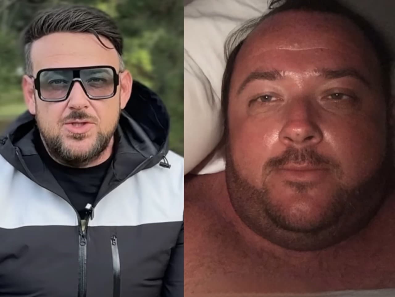 Lukáš Malínek: Po neuveriteľnej premene čakajú hereca tri operácie