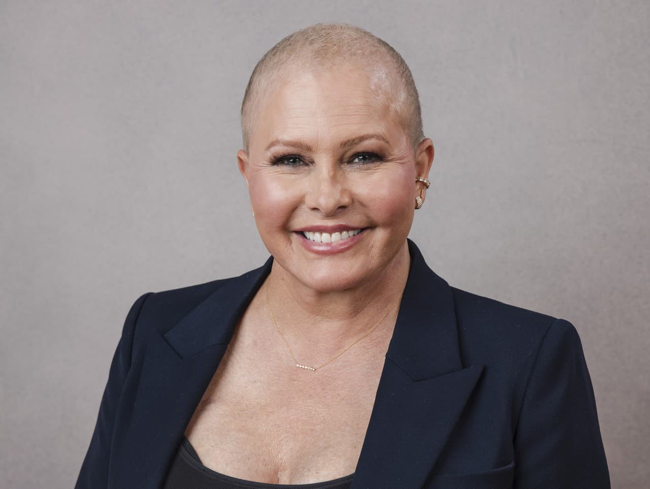 Nicole Eggert: Od boja s rakovinou k novému začiatku