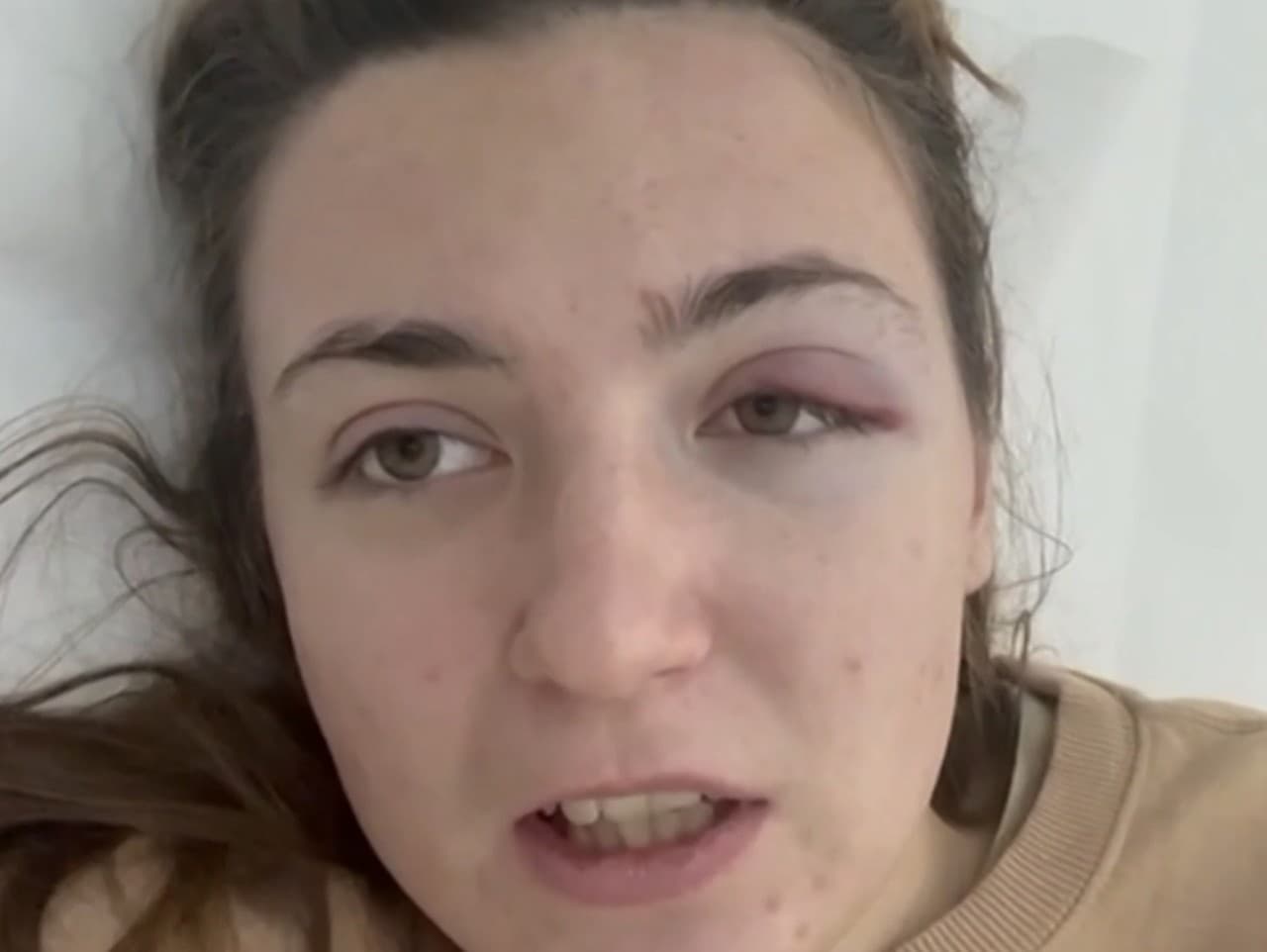 Zrážka vlakov pri Pezinku: Zranenia desiatok cestujúcich, vrátane redaktorky