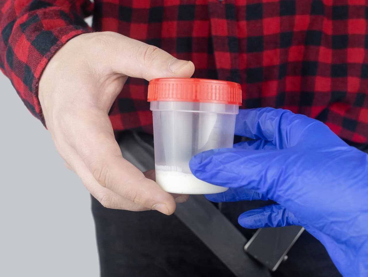 Šokujúci škandál: Darca spermií splodil 200 detí s genetickými problémami