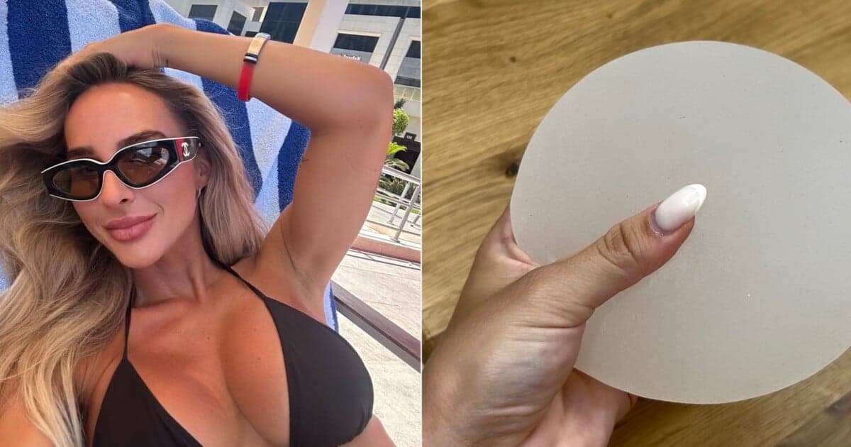 Augmentácia prsníkov: Prečo sa známe Slovenky rozhodli pre plastiku?