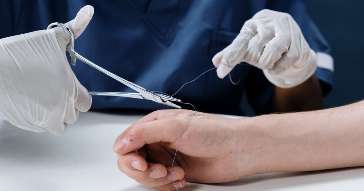 Sociálna poisťovňa zvyšuje kompenzácie za pracovné úrazy