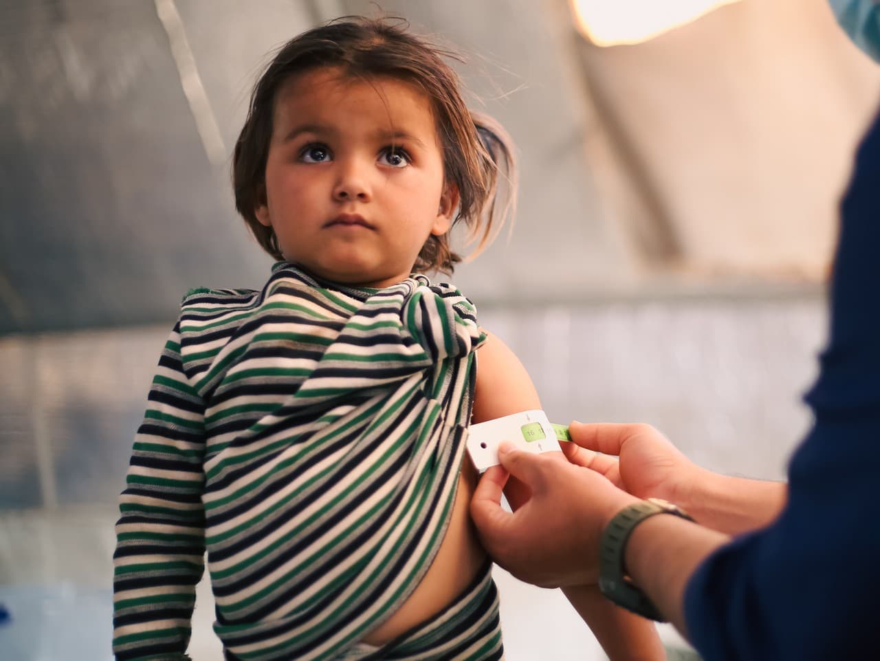 UNICEF varuje: Deti v Gaze trpia masovou podvýživou