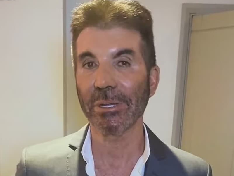 Simon Cowell otvorene o svojich plastických úpravách