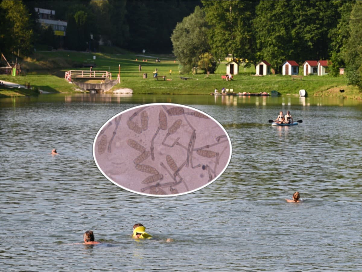 Nebezpečné parazity ohrozujú vodnú nádrž Stará Myjava