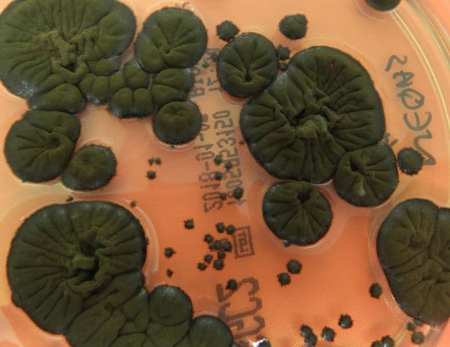 Záhadná čierna huba v Černobyle: Živí sa radiáciou?