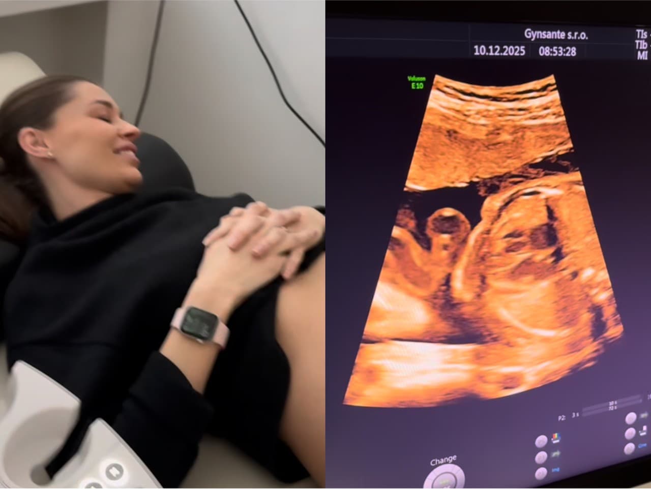 Ján Ďurica sa čoskoro stane trojnásobným otcom