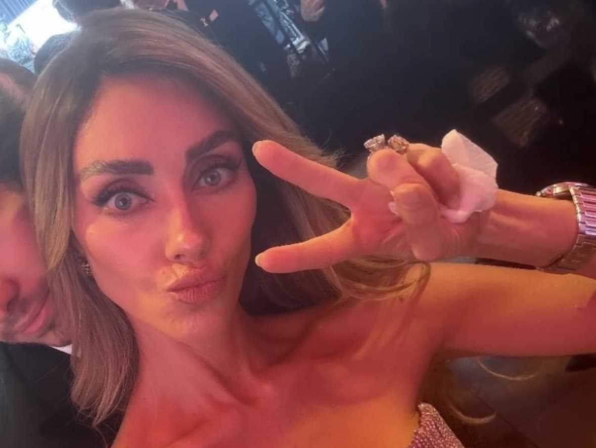 Anahí na Emmy: Zdravotné obavy z jej vychudnutej postavy