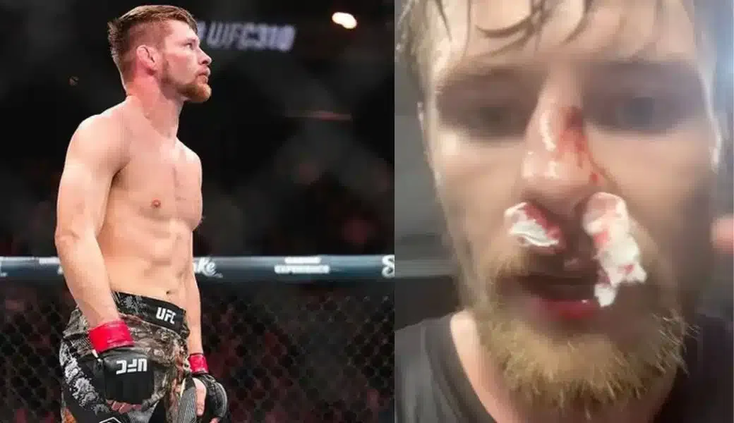 Kontroverzný UFC bojovník Bryce Mitchell hľadá pomoc na opravu nosa