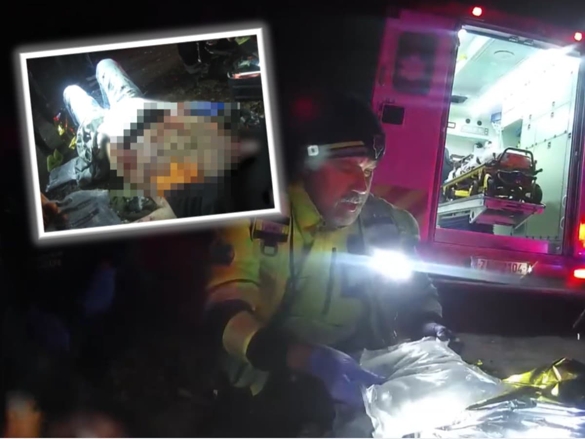 Petarda amputovala mužovi ruky, polícia zverejnila varovné video