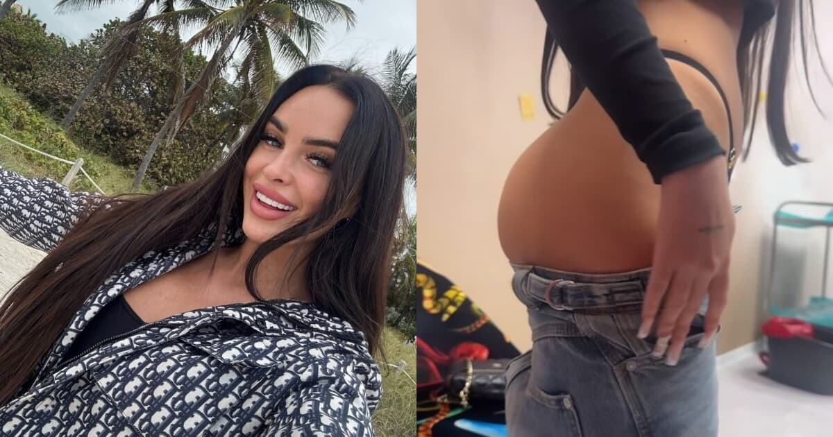 Nika zvolila neinvazívny zákrok: Kyselina hyalurónová na zväčšenie zadku