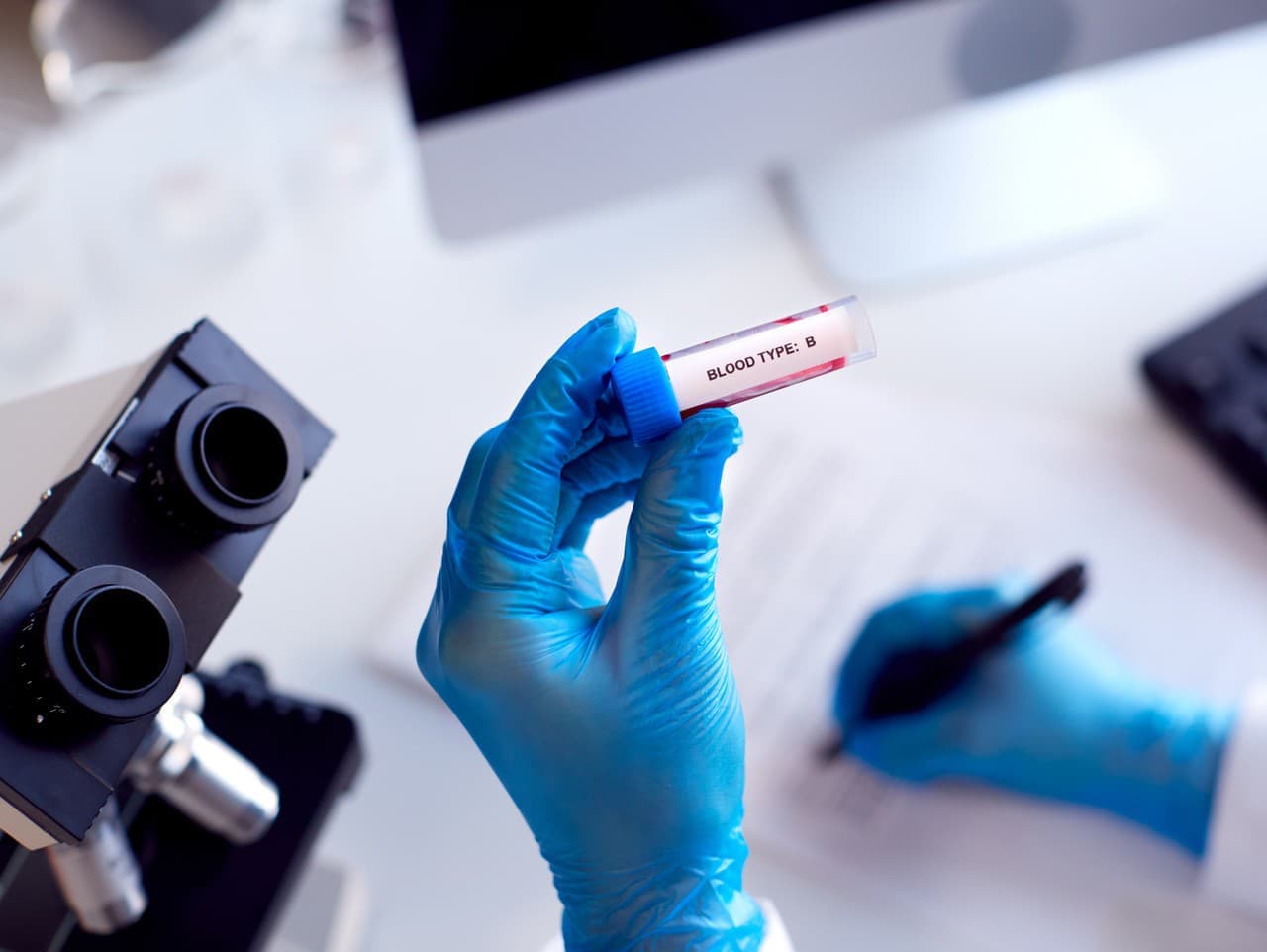 Krvná skupina A a riziko zlyhania pečene: Nové zistenia odborníkov