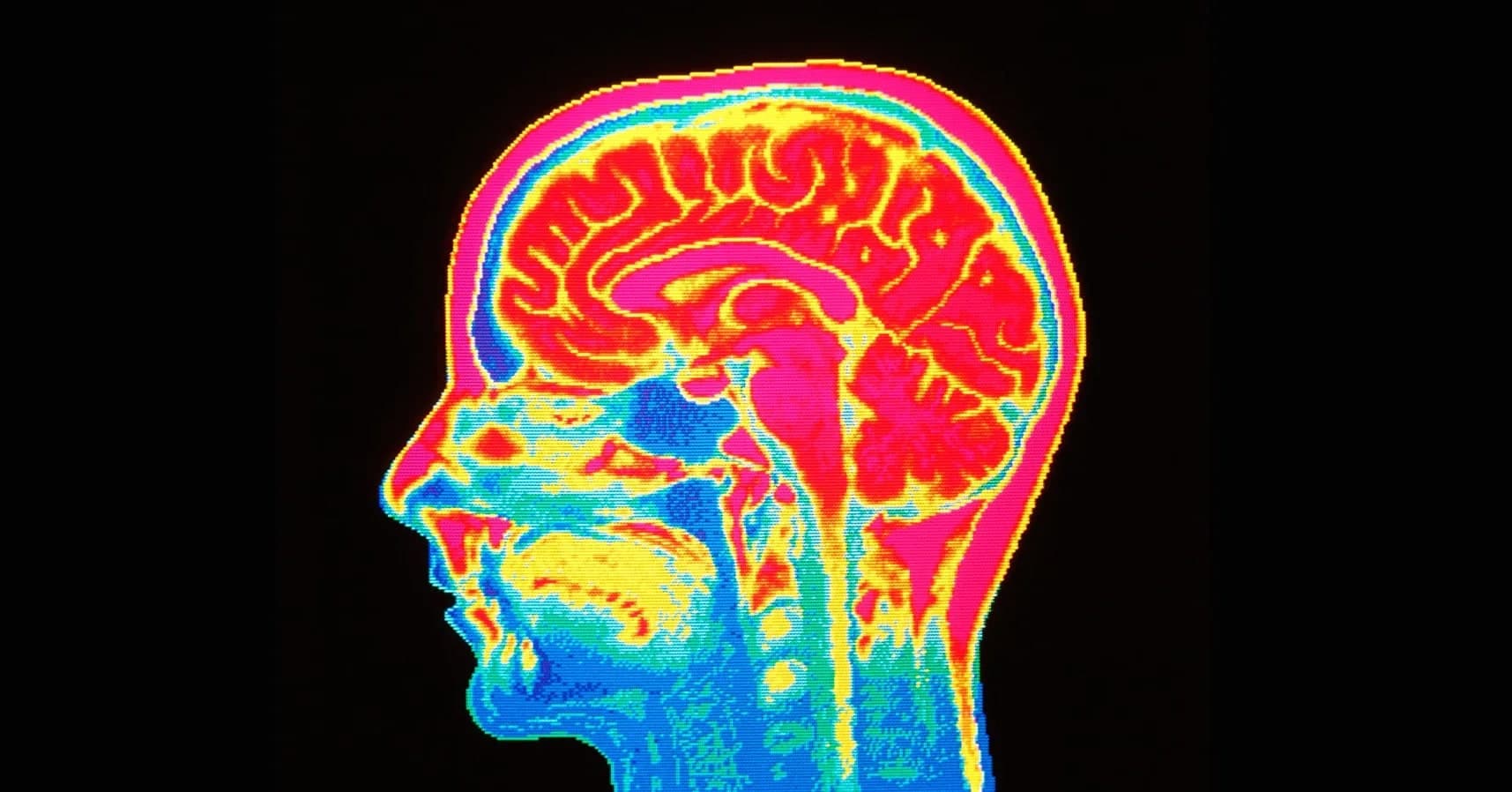 Puberta trvá do 32 rokov: Nový výskum odhaľuje fázy vývoja mozgu